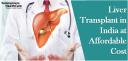 Liver Transplant in India at Affordable Cost logo